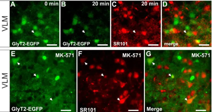 Figure 8. SR101 in neurons of the ventrolateral medulla. A–D: two-photon images from the SR101-labeling procedure of EGFP-labeled inhibitory neurons (GlyT2-EGFP) in the ventral-lateral medulla