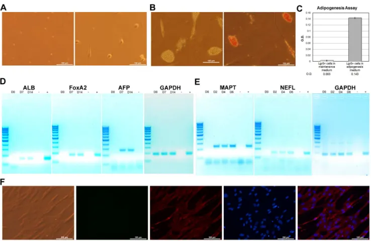 Figure 3. hBM-derived SB cells differentiate in vitro . A) SB cell attachment. Purified Lgr5+ cells at day 0 (left) and after attachment (right)