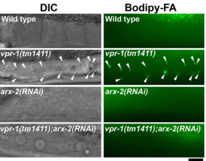 Figure 4. Effect of Arp2/3 inactivation on muscle fat levels. DIC and fluorescent images of muscle in live 3-day-old hermaphrodite worms fed Bodipy-FAs