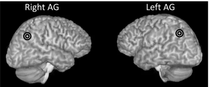 Figure 1. Stimulation sites in the right and left AG, in one participant.