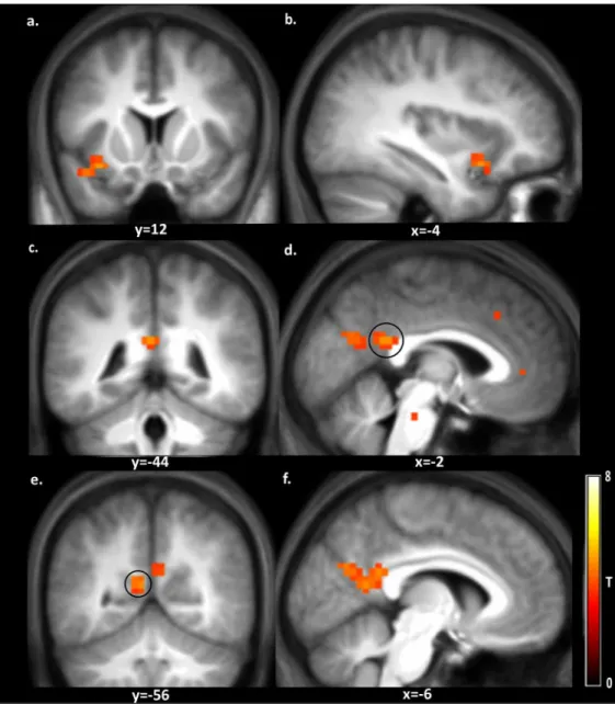 Fig 5. Brain regions with stronger activation in response to food choice versus non-food choice.