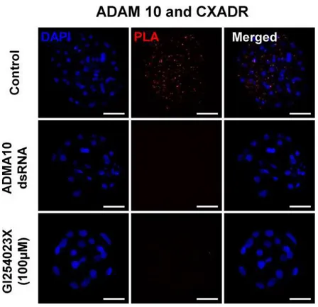 Fig 4. Treatment of morula embryos with ADAM10 inhibitor GI254023X. (A) Effects of the ADAM10 specific inhibitor on the transition from morula to blastocyst stage