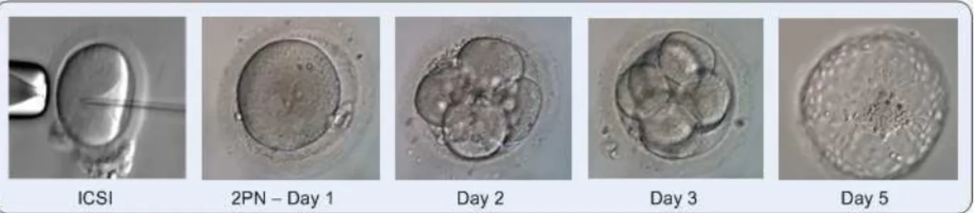 Figure 1: Human germ cells, Intra-Cytoplasmic Sperm Injection (ICSI)(ICSI is a method during which a single sperm cell is injected into the cytoplasm of the oocyte) and embryo growth day by day