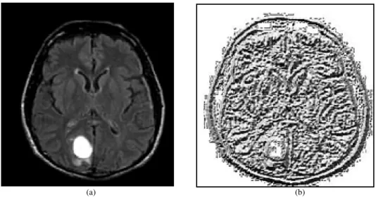 Fig. 2. (a) Source brain MR image (b) Local binary pattern feature MR image obtained using proposed method 