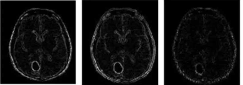 Fig. 3. Gray level based feature extracted MR image simulated using MATLAB