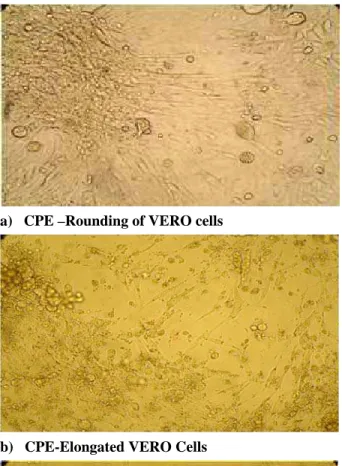 Fig. 3: Cytopathic effects (CPE) on VERO cells due  to PPRV and TEM of PPR virion isolated  from Bulki sheep