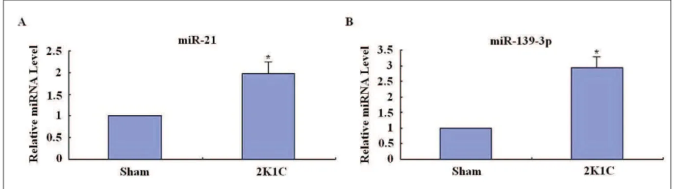 Fig. 2. Relative expression levels of miR-139-3p, miR-21 and U6 snRNA in 2K1C (n=14) and sham-operated rats (n=12)