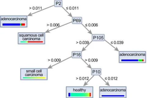 Fig. 6. A decision tree algorithm could separate small cell carcinoma, squamous cell carcinoma and adenocarcinoma.
