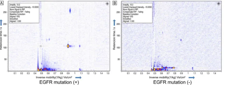 Fig. 5. IMS chromatogram in patients with lung adenocarcinoma positive for EGFR mutation (A) and negative for EGFR mutation (B).
