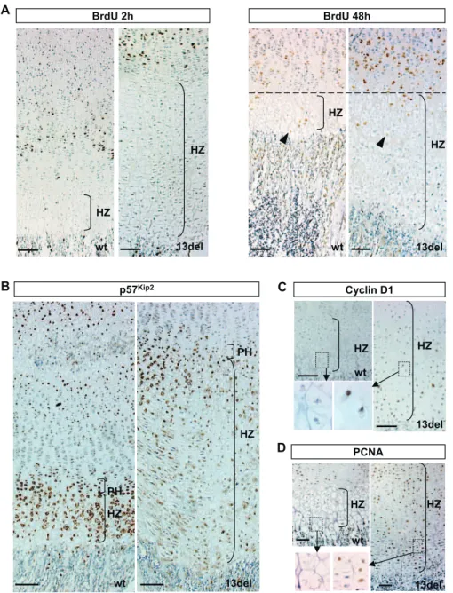 Figure 4. Abnormal Cell-Cycle Regulation in 13del HCs