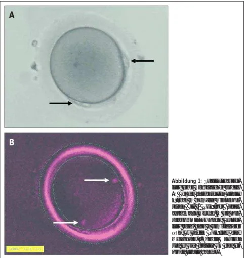 Abbildung 1: Qualitätsbeurtei- Qualitätsbeurtei-lung einer menschlichen Eizelle.