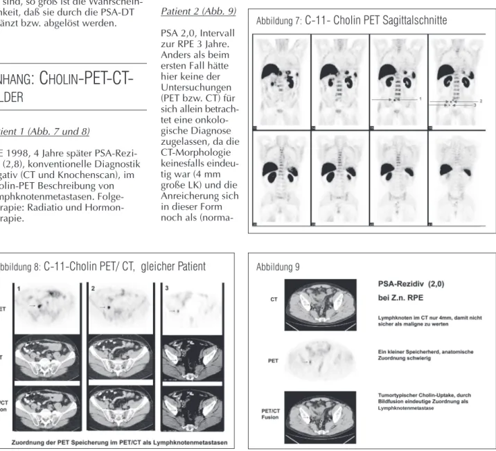 Abbildung 7:  C-11- Cholin PET Sagittalschnitte
