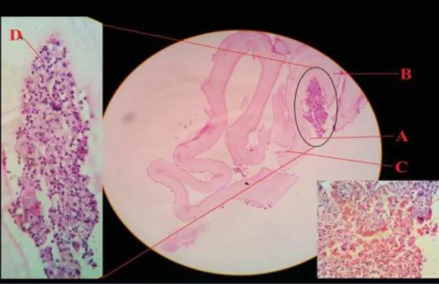 Fig. 2: Microscopic appearance showing A-Outer adventitial  layer, B-Middle laminated layer, C-Inner Germinal layer, 