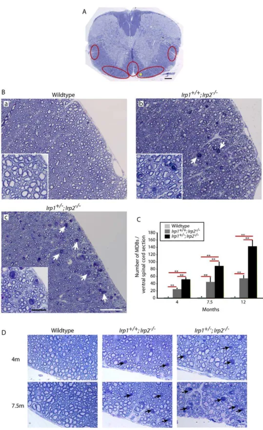 Figure 1. Axonal degeneration in the spinal cord of Irp2 -null mice. A; Toluidine blue staining of Epon-embedded spinal cord cross-sections at 12 months