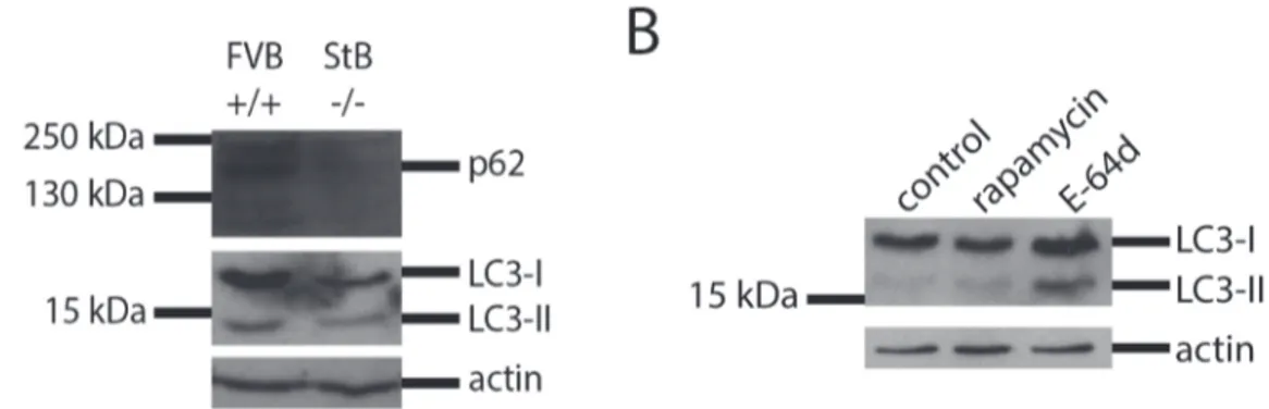 Figure 5. Western blot analysis of the protein expression of LC3-I and LC3-II in primary astrocytes after the addition of stefin B to the medium