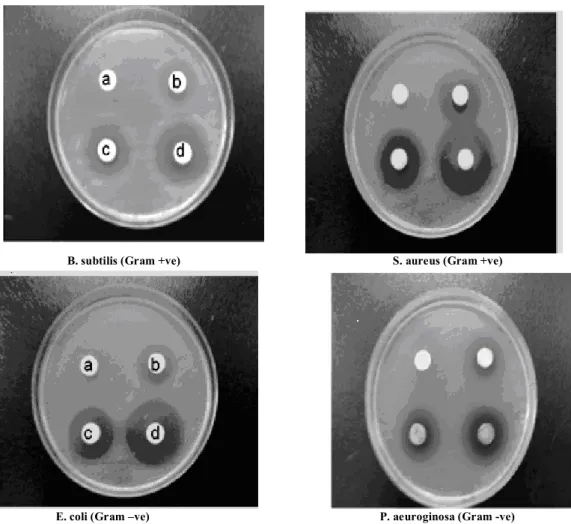 FIGURE 1: ANTIMICROBIAL ACTIVITY OF METHANOLIC EXTRACT OF SEEDS OF PHYLA NODIFLORA LINN