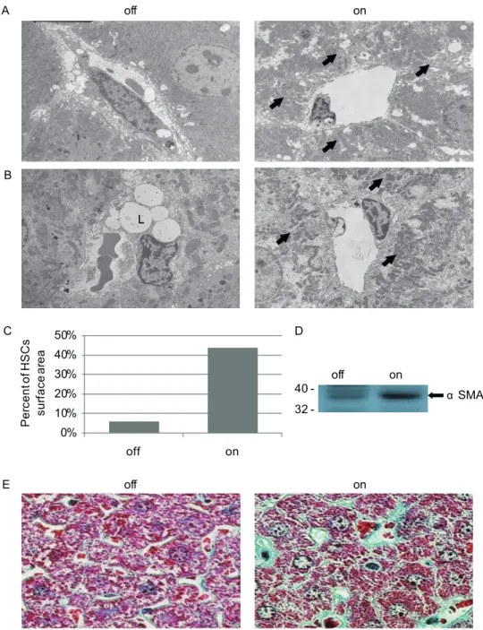 Figure 3. sVEGF-R1 expression in the adult liver causes activation of HSCs. (a) Scanning electron microscopy of sinusoids in ‘off’ (a control littermate) vs