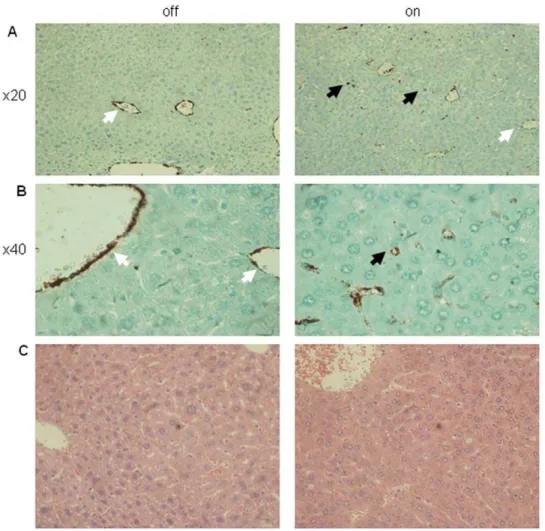 Figure 4. Sinusoidal capillarization in sVEGF-R1 expressing livers without parenchymal damage