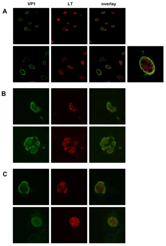 Figure 7. Subcellular localization of LT-Ag and VP1 protein in cells transfected with religated viral DNA