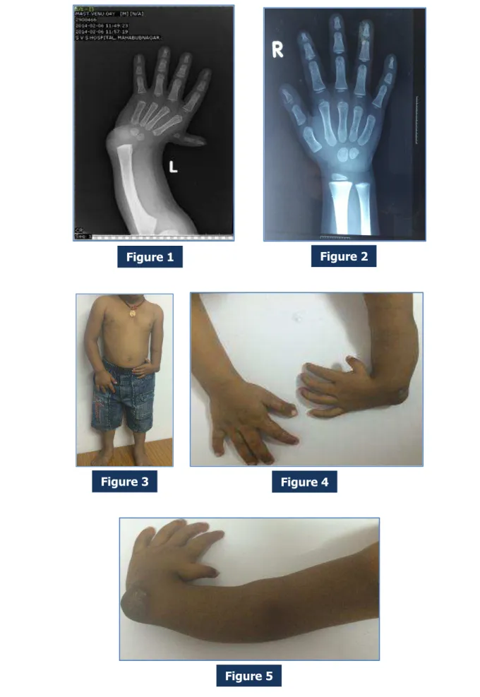 Figure 1 Figure 2