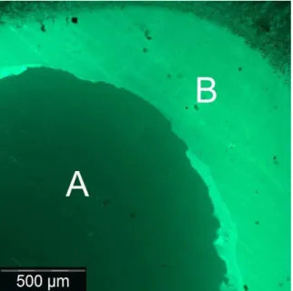 Figure 4. Fluorescence microscopy of a specimen after  shear bond test. A = zirconia surface after adhesive  failure