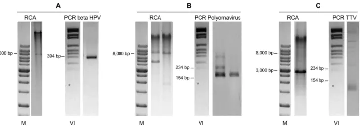 Figure 5. RCA analysis and specific PCR analysis of Linear Array-negative, RCA positive samples