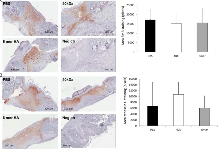 Figure 5. 6mer HA and 40 kDa HA has no significant effect on Smooth muscle actin or Tenascin C expression during wound repair.