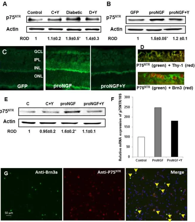 Figure 4. Diabetes and overexpression of proNGF induced expression of p75 NTR in vivo and in vitro