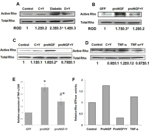 Figure 5. ProNGF selectively activates RhoA kinase activation in vivo and in RGC cultures