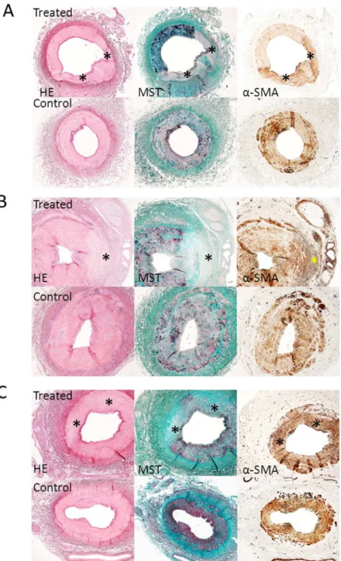 Fig 1. Acute, 3 weeks, and 3 months follow-up histology results. Acute (A), 3 weeks (B) and 3 months (C) histology results (2x magnification) showing treated vessels with lesions and control vessels