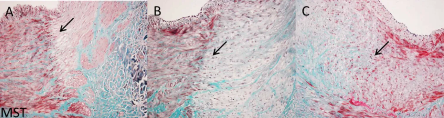 Figs 4 – 6 display the immunohistochemical staining of the nerve fibers. All nerves contained TH-positive nerve fibers (Fig 5).