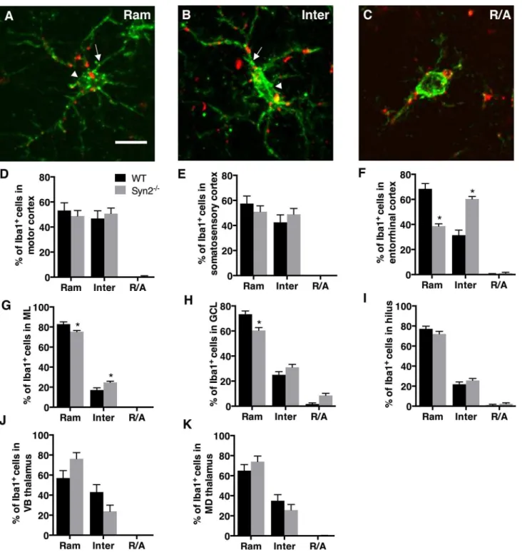 Fig 1. Microglial activation in epileptogenic 1-month old Syn2 -/- mice. Images showing Iba1/ED1 immunolabeling of microglia representing three different morphological phenotypes: ramified (Ram; A), intermediate (Inter; B) and round/amoeboid (R/A; C)