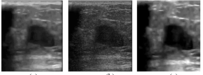 Figure  1b  demonstrates  suppression  of  homogenous  noise  at  σ  =  0.015.  Figure  1c  shows  the 