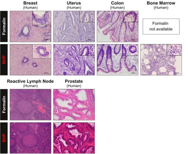 Table 2. Independent evaluation of human colon mucosa by two pathologists.