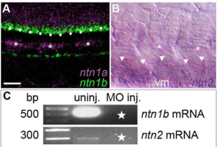 Figure 6. Netrin mRNAs are expressed at intermediate targets (blue ellipses) of the CaP axon as it extends ventrally