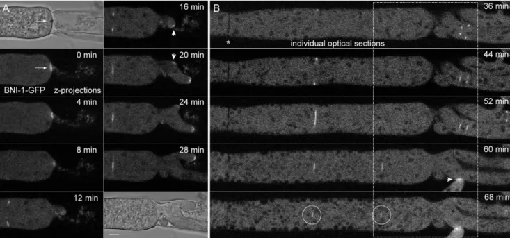 Figure 14. BNI-1 localization during conidiogenesis. (A) During cytological compartmentalization of conidiophores BNI-1 localized to forming septa (arrowheads)