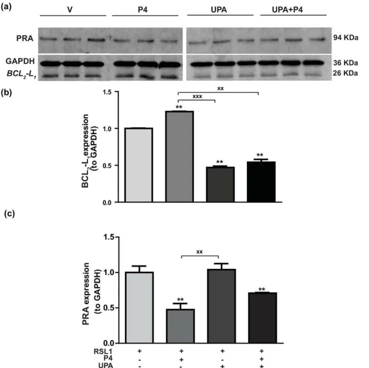 Fig 5. Hormonal regulation of BCL 2 -L 1 protein expression in MDA-iPRA cells. Following 24 h induction of PRA expression using RSL1 (0.5 μM), MDA- MDA-iPRA cells were incubated in the presence or absence of P4 (1 nM) and/or UPA(1 μM) in steroid-free mediu