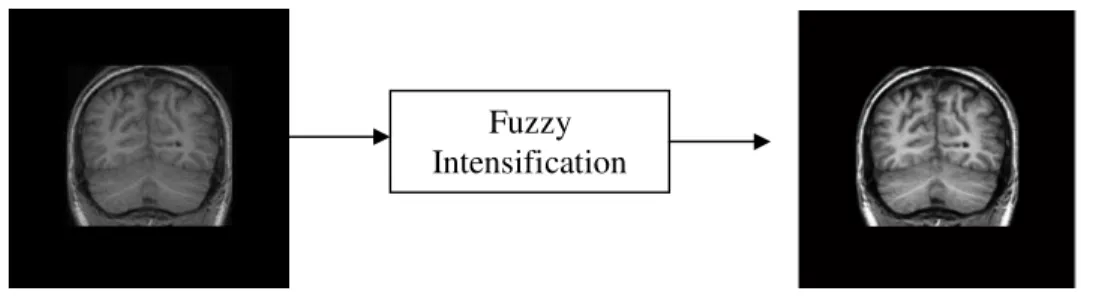 Figure 3. Contrast Enhancement 2.1.2 Fuzzy Segmentation 