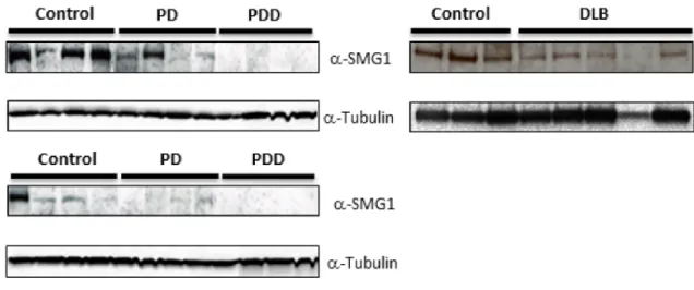 Figure 7. SMG1 expression is reduced in Parkinson’s disease (PD), Parkinson’s disease with dementia (PDD), and dementia with lewy bodies (DLB) in brain regions with known increases in p-syn expression