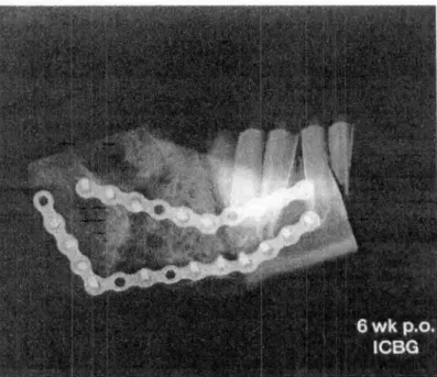 Figura 2- Radiografia tomada 6 semanas  após o sacrificio  da cabra sem PRP. Observe que as li- li-nhas de osteotomia  e perfurações  da broca estão ainda  visíveis,  enquanto Areas radiolócidas são vistas  dentro do sitio enxertado.A formação óssea perios
