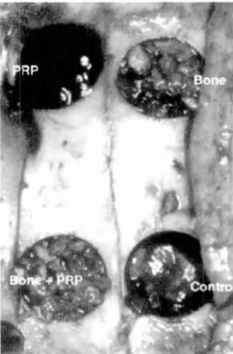 Figura 6- Radiografia do  crânio  do coelho tomada após 2 meses de cicatrização (A, PRP; B, os- os-so; C, osso + PRP;  e D,  controle)