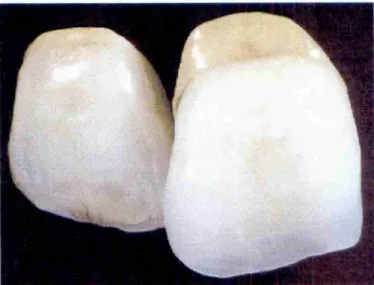 Figura 17 - Dentes de porcelana elaborado com porcelana Duceragold (Ducera Dental). 