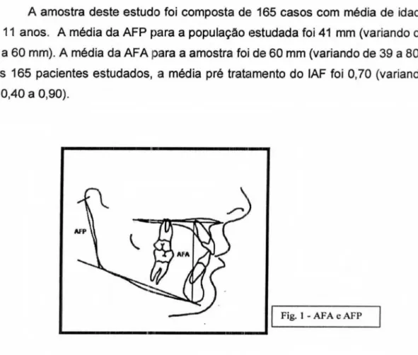 Fig.  1 - AFA  e  AFP 