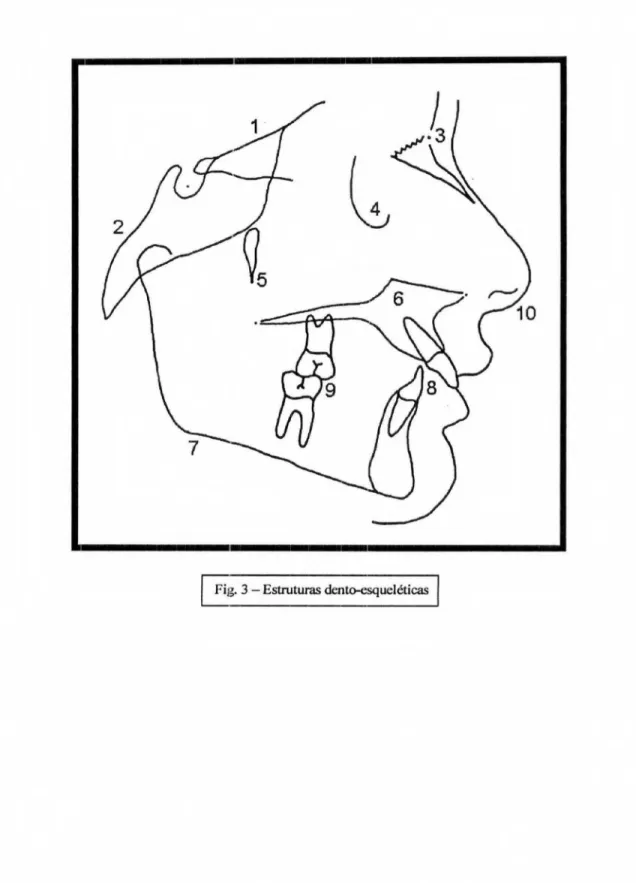 Fig.  3 —  Estruturas  dento-esquelétira_s 