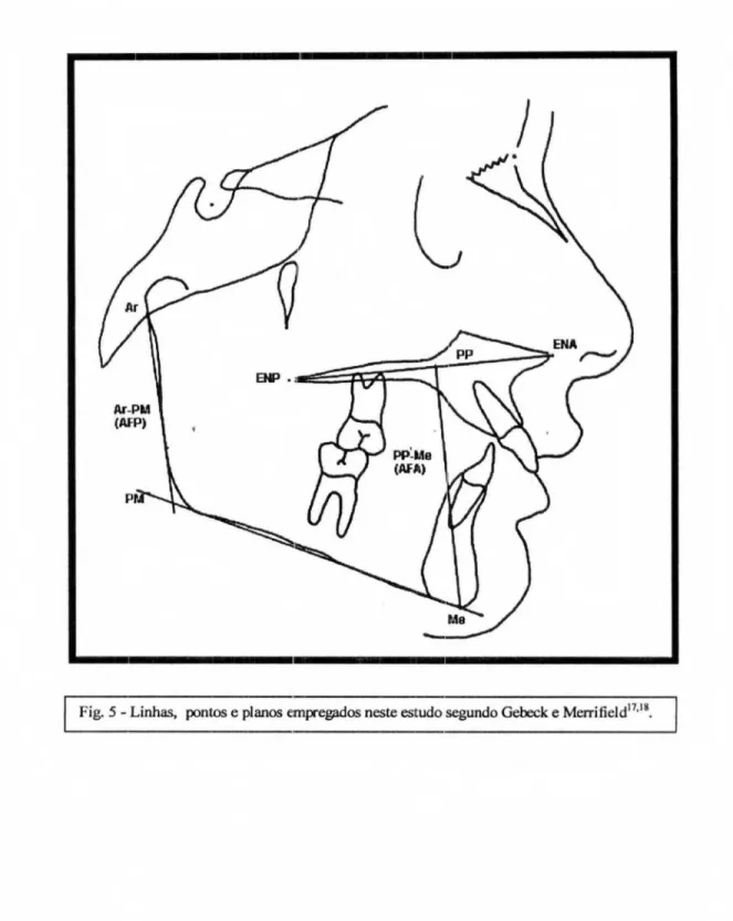 Fig. 5 - Linhas, pontos  e  planos empregados neste estudo segundo Gebeck  e Merritield&#34;.&#34;