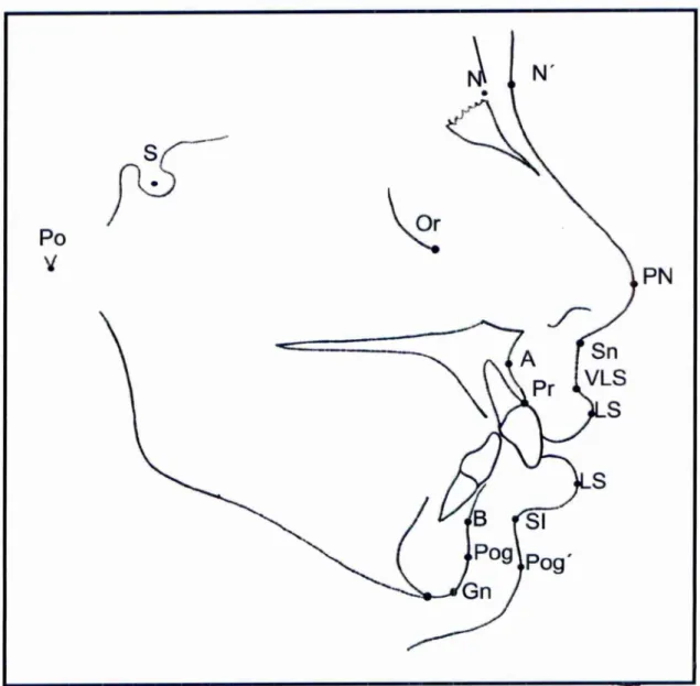 Figura  2 - Demarcação  dos pontos  cefalométricos, S  (sela),  N (nisio), N' (tecido  mole do  násiq), i\ (ponto  A),  B  (ponto B),  Pr  (próstio),  Po  (pório),  Or  (orbitário), Pog (pog8nio), Pog' (pog8nio  mole), Sn  (subnasap, PN (ponta  do nariz), 