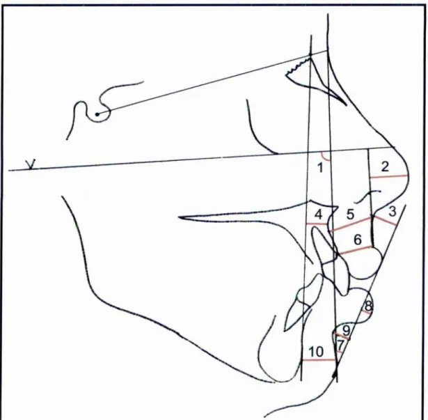 Figura 4 - Medidas empregadas, 1: Angulo facial do tecido mole, 2: proeminência nasal, 3: subnasal-linha H, 4: 