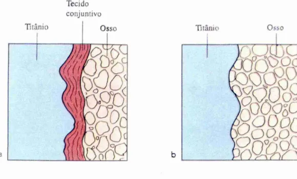 FIGURA 1- Desenho esquemático de  fibrointegração  (a)  e  osseointegração (b). 