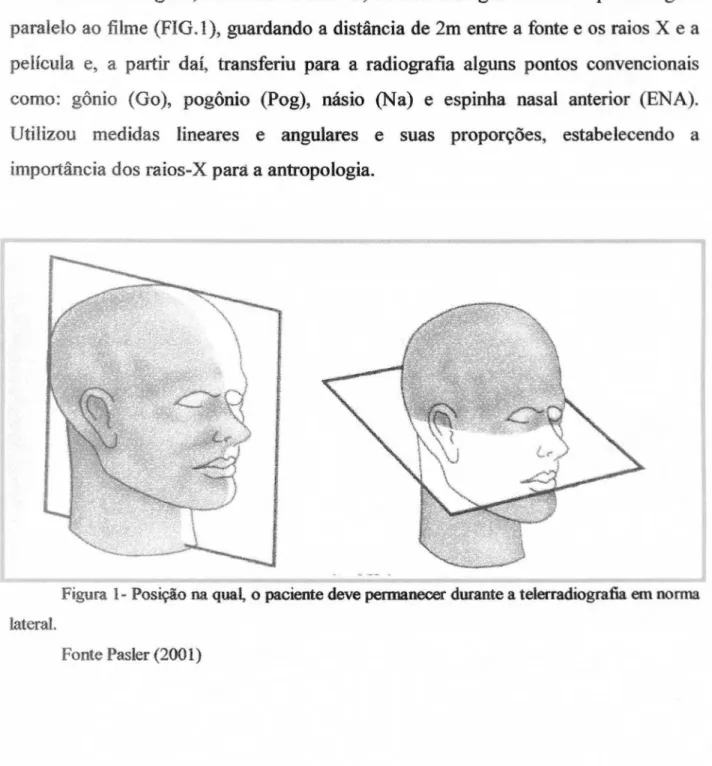 Figura  1-   Posição  na qual,  o paciente deve permanecer durante a  telerradiografia  em norma  lateral