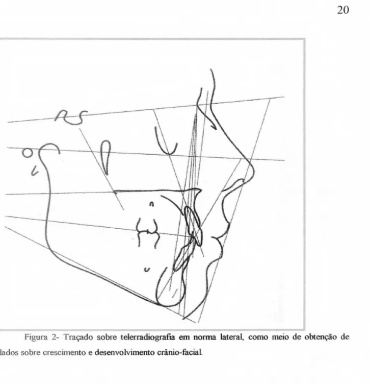 Figura 2- Traçado sobre telerradiografia  em norma lateral, como meio de  obtenção   de  dados sobre crescimento  e  desenvolvimento   crânio -facial